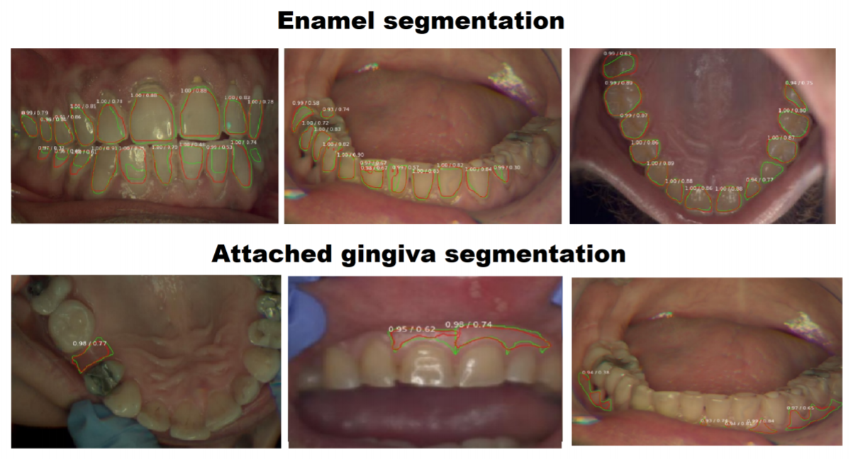 deep learning  dental hyperspectral imaging